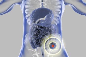 No differences in oncologic outcomes occurred between mandatory TME or selective WW strategy in rectal cancer responders to neoadjuvant therapy.
