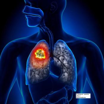 lung tumor