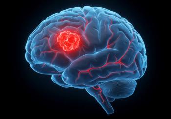 NCCN Expands Glioma Guidelines: © Arif - stock.adobe.com