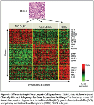 Appropriate Management of Molecular Subtypes of Diffuse Large B-Cell Lymphoma