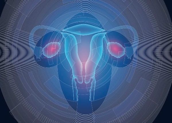 Patients with cervical cancer with cachexia, sarcopenia, and malnutrition had higher mortality when receiving concurrent chemoradiotherapy.