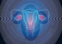 Patients with cervical cancer with cachexia, sarcopenia, and malnutrition had higher mortality when receiving concurrent chemoradiotherapy.