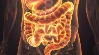 MRD Test in Colorectal Liver Metastases: © 波 刘 - stock.adobe.com