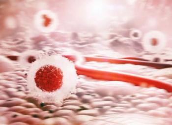 Opioid Use Disorder and Overdose Found to Be Rare but Significant After Stage II/III Colorectal Cancer Diagnosis