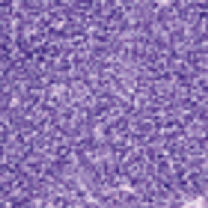 Thymoma: Current Concepts