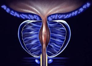 Darolutamide Does Not Alter Metastatic Progression Pattern in nmCRPC in ARAMIS