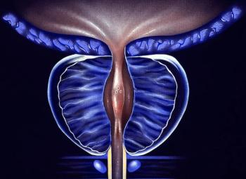 Wellbeing Scores for Patients With Advanced Prostate Cancer Tied to Deep PSA Response