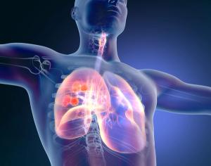 Tracing Steps of Clinical Research in Lung Cancer
