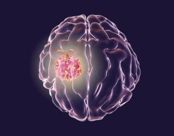 Lobaplatin Combination Regimen May Minimize Toxicity in HNSCC