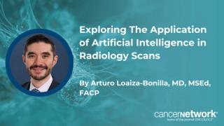Artificial intelligence may be used in CT scans to help detect early-stage disease in at-risk patients undergoing screening for cancer.