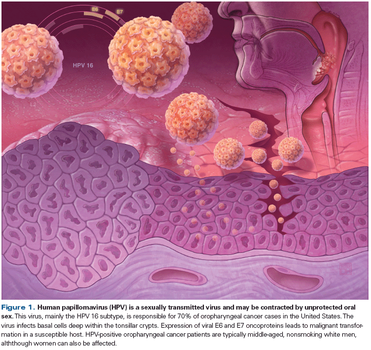 A humán papillómavírus és a rák