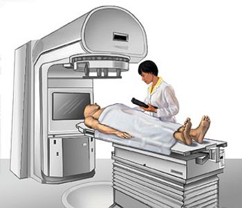 Patients with painful lesions who did not undergo treatment with opioids or reirradiation generally had better outcomes than those who did.