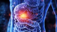 Futibatinib, Pemigatinib, Lirafugratinib Yield Similar PFS in FGFR-Altered Biliary Tract Cancers: © Thipphaphone - stock.adobe.com