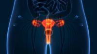FDA Grants BTD to BI-1808 in Ovarian Cancer Population: © magicmine - stock.adobe.com