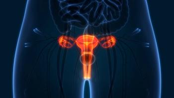 FDA Grants BTD to BI-1808 in Ovarian Cancer Population: © magicmine - stock.adobe.com