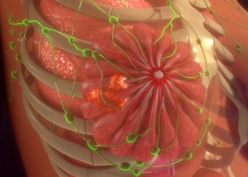 Screening frequency appears to be a weak risk factor for advanced breast cancer, with obesity in post-menopausal and dense breasts in pre-menopausal patients being more prominent factors.