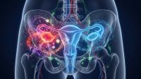 ASCO Issued Guidelines for Recurrent Ovarian Cancer: © Tabinda - stock.adobe.com