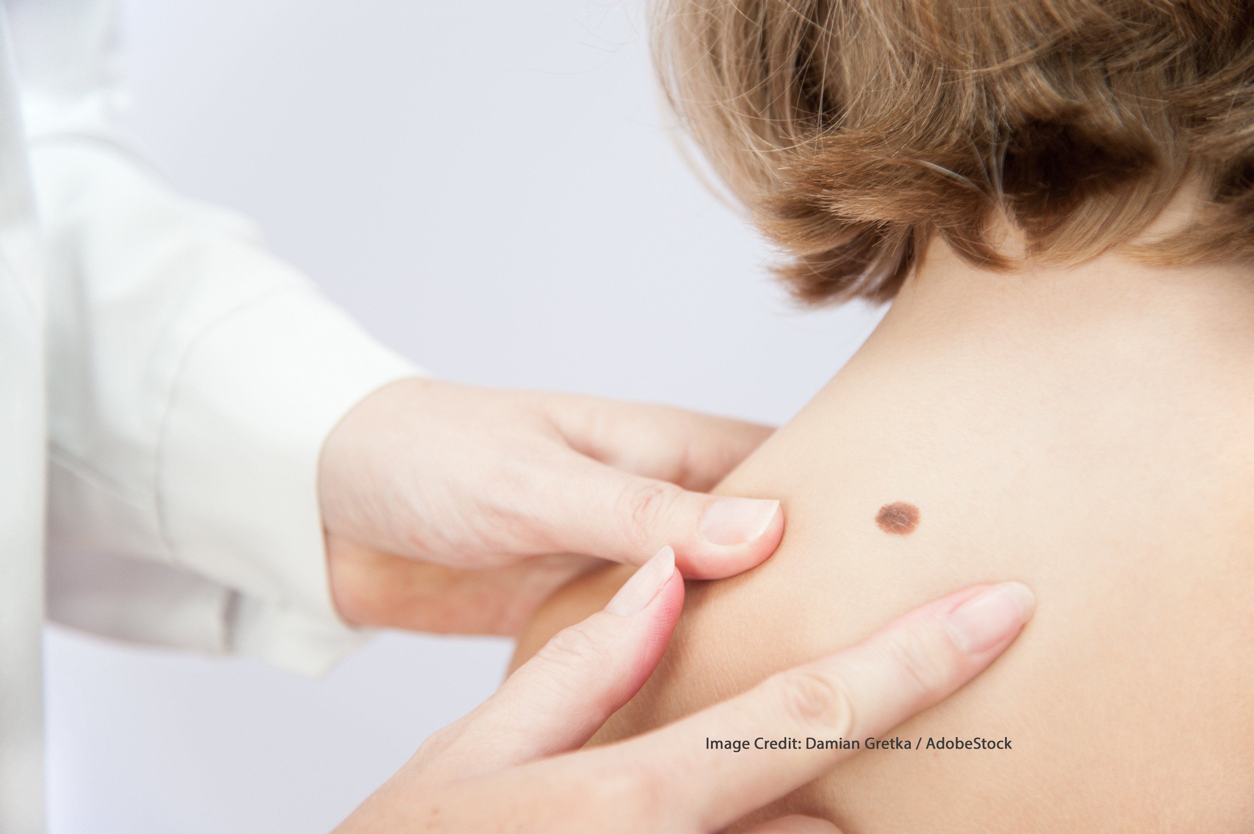 Hpv vaccine skin cancer. Hpv virus en zwanger willen worden