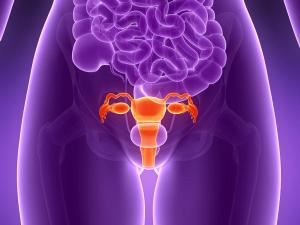 Multi-Trial Analysis Indicates Niraparib Maintenance for BRCA+ Ovarian Cancer Leads to PFS Benefit Across Settings