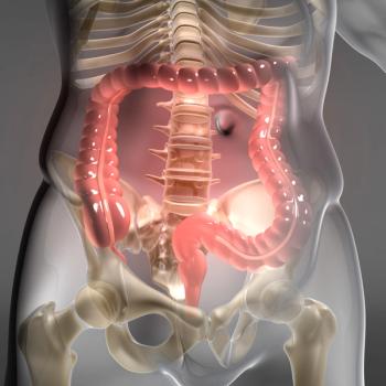 Synchronous metastatic status does not appear to affect survival among patients with resected BRAF V600E-mutated metastatic colorectal cancer.