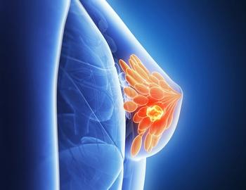 Those with higher Oncotype DX Scores may be more likely to complete the recommended 5 years of endocrine therapy for breast cancer.