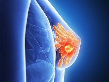 Those with higher Oncotype DX Scores may be more likely to complete the recommended 5 years of endocrine therapy for breast cancer.