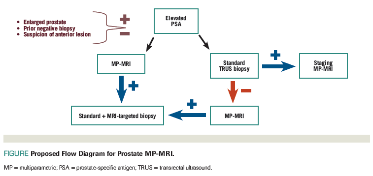 multiparametric prostate mri cpt code Prostatitis férfiaknál 30 évig