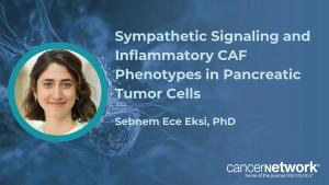 According to Sebnem Ece Eksi, PhD, sympathetic signals led to shifts in cancer-associated fibroblasts to a more inflammatory state.