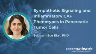 According to Sebnem Ece Eksi, PhD, sympathetic signals led to shifts in cancer-associated fibroblasts to a more inflammatory state.