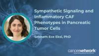 According to Sebnem Ece Eksi, PhD, sympathetic signals led to shifts in cancer-associated fibroblasts to a more inflammatory state.