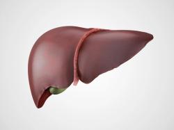 HCC Related to Nonalcoholic Fatty Liver Disease Vs Other Causes Linked With Lower Rates of Cirrhosis, Surveillance 