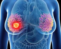T-DXd/Pertuzumab Earns Type II Application Validation in EU for HER2+ mBC