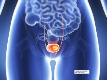 Bladder cancer, bladder tumor, urothelial cancer