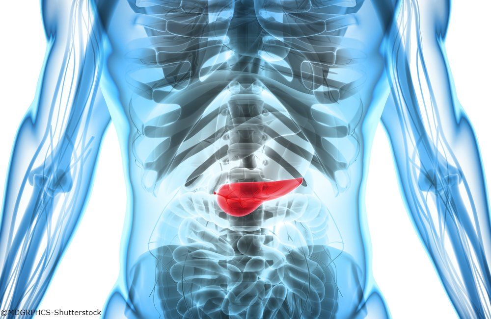 FDA Gives Orphan Drug Designation to Mitazalimab in Pancreatic Cancer | Image Credit: © MDGRPHCS - www.shutterstock.com.