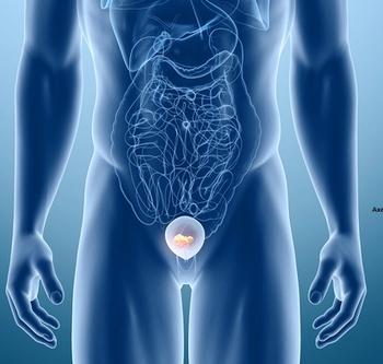 Detalimogene voraplasmid demonstrated a 71% any-time CR rate in this non-muscle invasive bladder cancer population in the phase 1/2 LEGEND trial. 