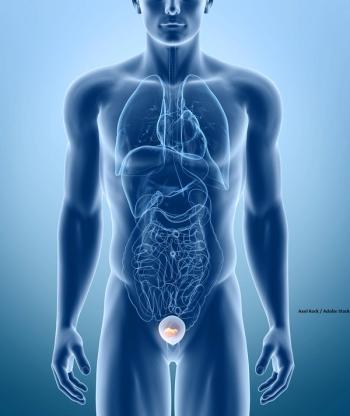The 2-year rates for disease-free survival in the radiation and observation arms, respectively, were 71.6% vs 58.7%.
