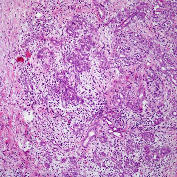 Patient Presents With Epigastric Pain