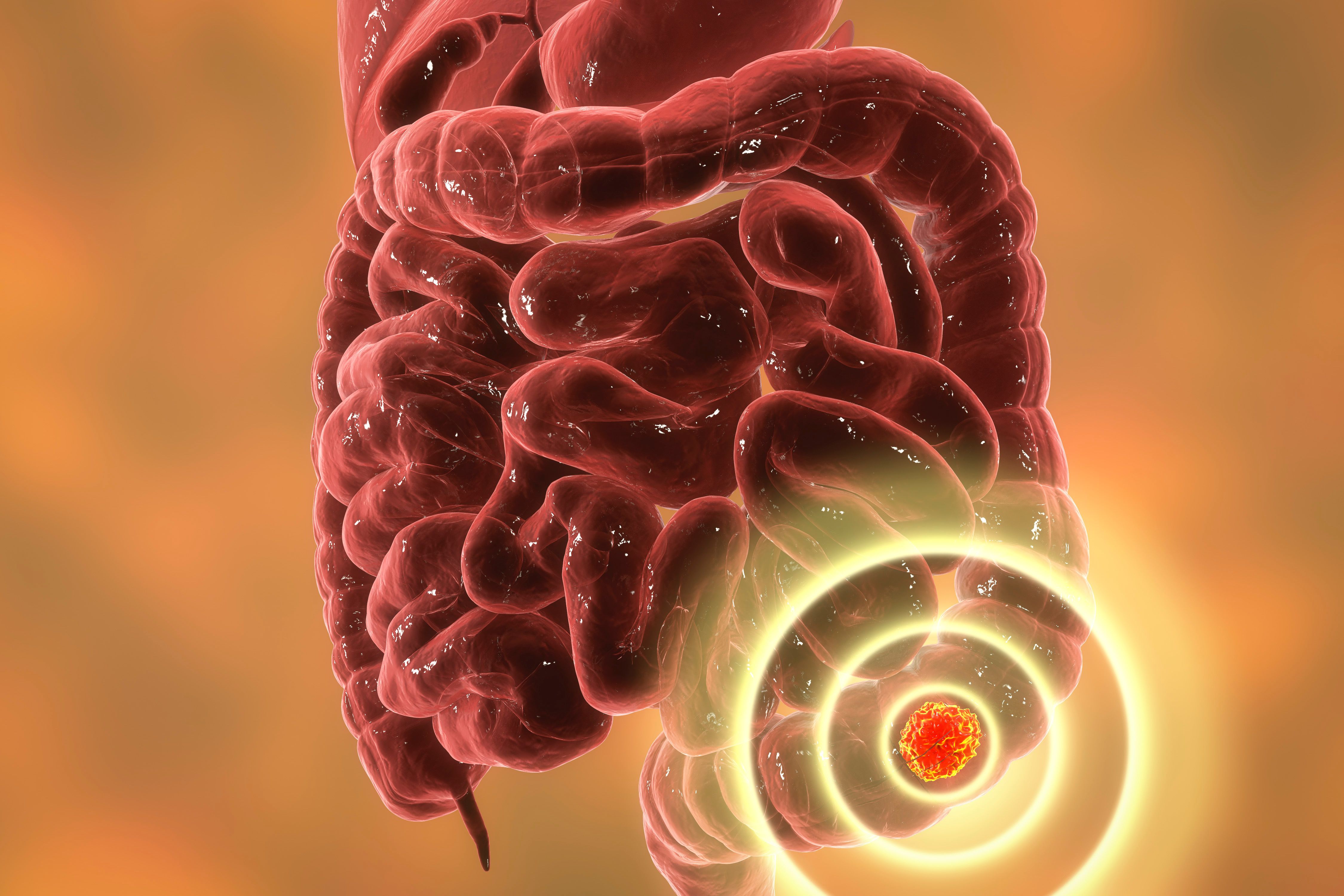 Vilamakitug Plus Chemo Meets Survival Threshold in Refractory Metastatic CRC: © Dr_Microbe - stock.adobe.com