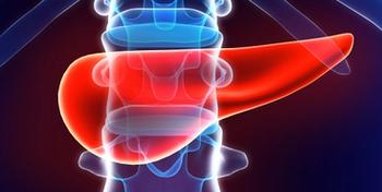 Stereotactic online adaptive magnetic resonance guided radiation therapy was well tolerated and maintained stable QOL in patients with PDAC for up to 1 year.