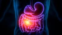Baseline Plasma DKK1 Predicts Deepening Sirexatamab Benefit: © vladim_ka - stock.adobe.com