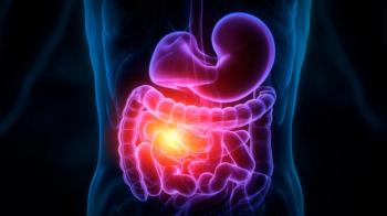 Baseline Plasma DKK1 Predicts Deepening Sirexatamab Benefit: © vladim_ka - stock.adobe.com