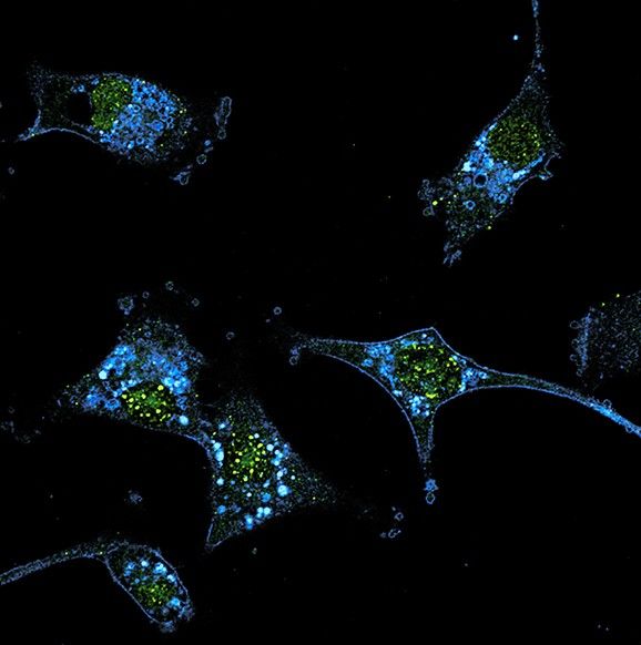 At 4 years, about 20% of patients with advanced melanoma who received tumor-infiltrating lymphocyte therapy were alive and responding to treatment.