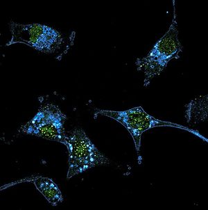 At 4 years, about 20% of patients with advanced melanoma who received tumor-infiltrating lymphocyte therapy were alive and responding to treatment.