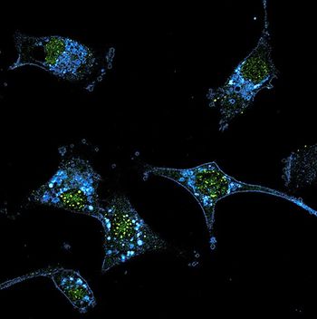At 4 years, about 20% of patients with advanced melanoma who received tumor-infiltrating lymphocyte therapy were alive and responding to treatment.