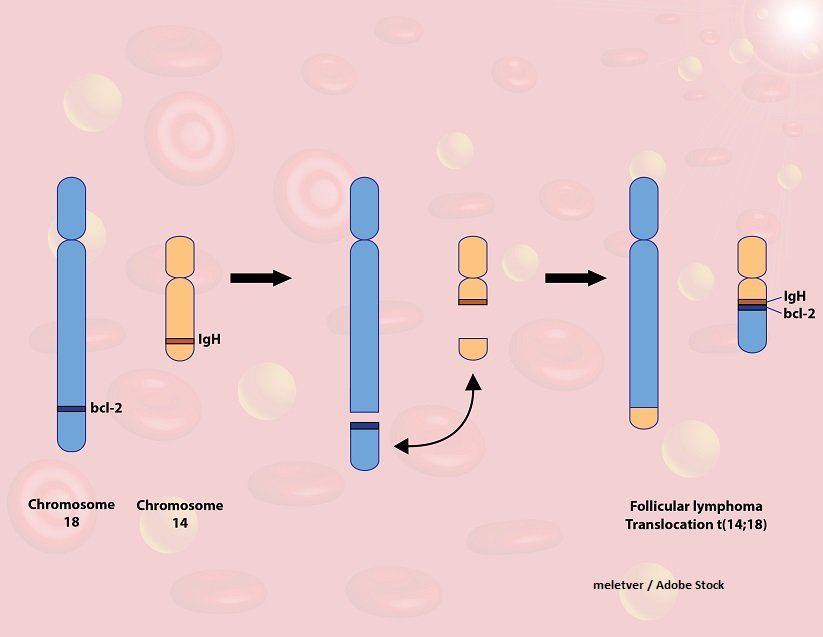 follicular lymphoma