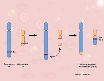 follicular lymphoma
