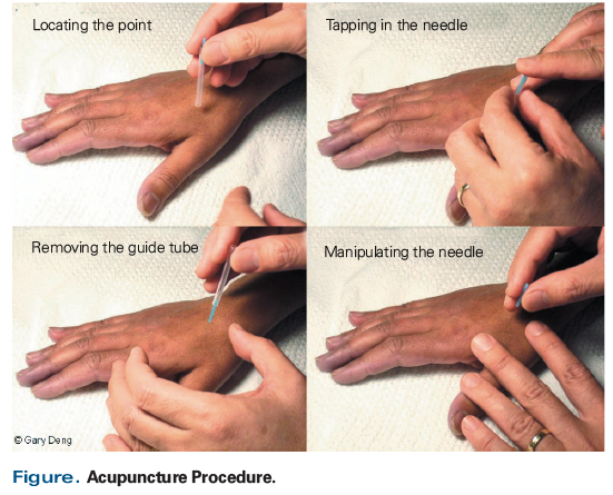 acupuncturist albuquerque