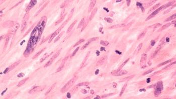 FDA Clears HLA Typing Companion Diagnostic for Afami-cel in Sarcoma | Image Credit: © David A Litman - stock.adobe.com.