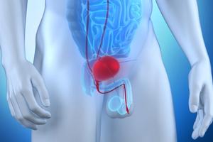 Data from POTOMAC support durvalumab plus BCG and induction and maintenance therapy as a new treatment option in BCG-naive, high-risk NMIBC.
