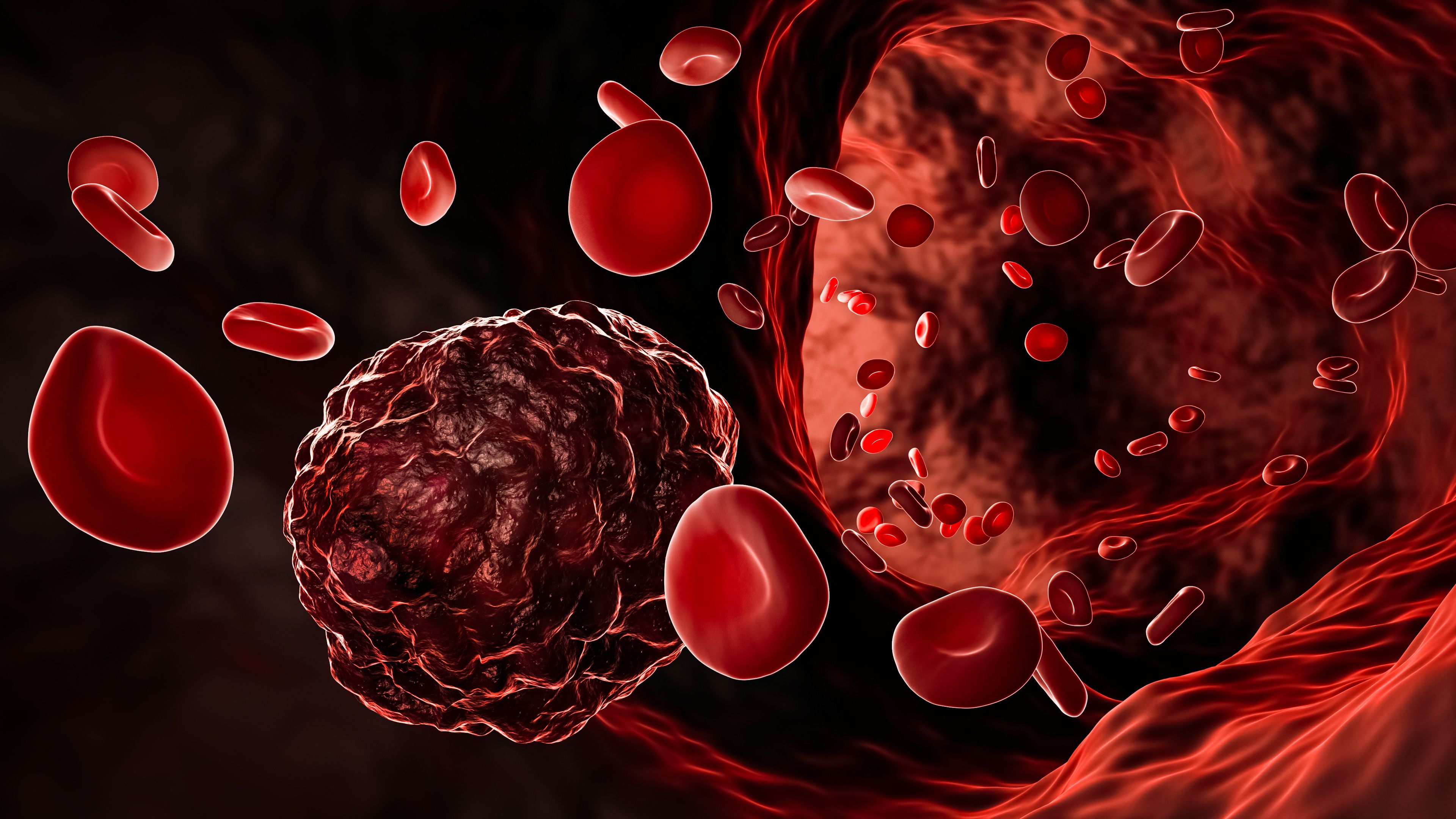 Cancer cell or cancerous tumor amidst flowing red blood cells in a blood vessel, artery or vein 3D rendering illustration. Medicine, pathology, oncology, disesase, science concepts. | Image Credit: © Matthieu - stock.adobe.com